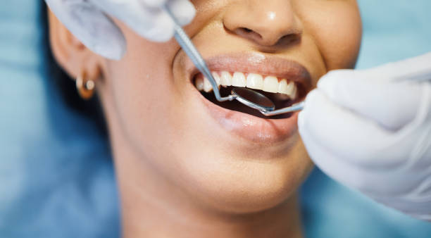 Best Dentist for Dental Trauma  in Clarks Green, PA